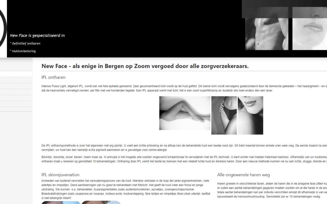 New-Face Bergen op Zoom